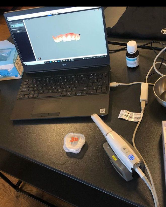 CLIK-FIT | Custom hockey mouthguard